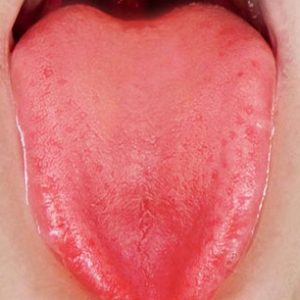 Tip the Tongue Red