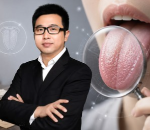 Advance Tongue Diagnosis